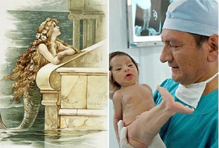 Những hội chứng “nghe tên đã thấy sợ” mà loài người từng mắc phải ảnh 2 Những hội chứng “nghe tên đã thấy sợ” mà loài người từng mắc phải ảnh 2