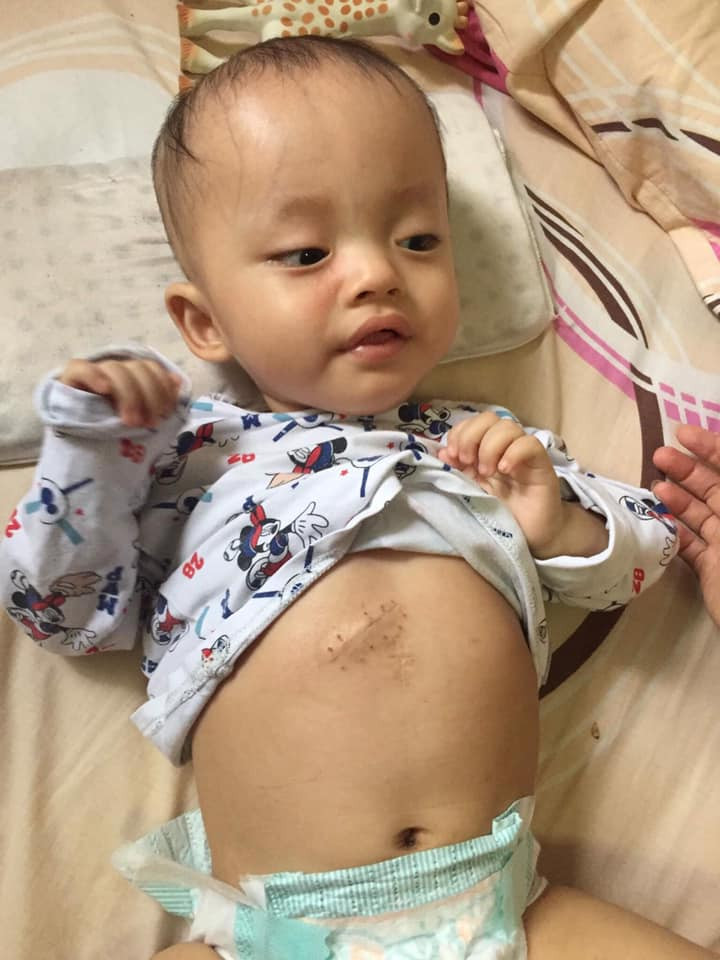 Thấy mắt em bé bị lệch, mẹ Hà Tĩnh chết đứng khi nghe bác sĩ kết luận ảnh 7 thay mat em be bi lech, me ha tinh chet dung khi nghe bac si ket luan: benh nang - 8