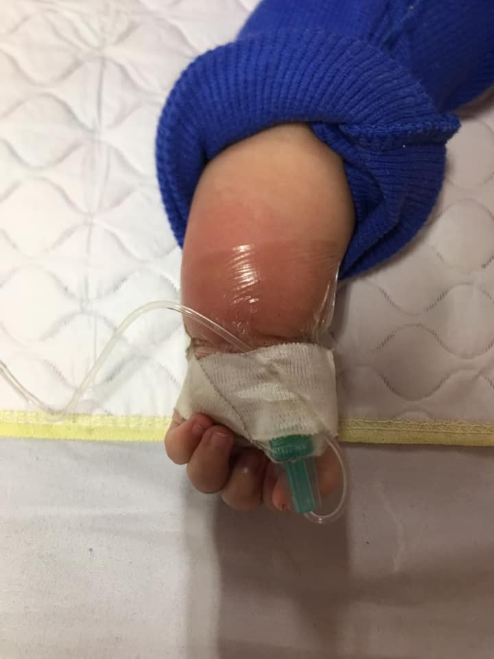 Thấy mắt em bé bị lệch, mẹ Hà Tĩnh chết đứng khi nghe bác sĩ kết luận ảnh 3 thay mat em be bi lech, me ha tinh chet dung khi nghe bac si ket luan: benh nang - 4