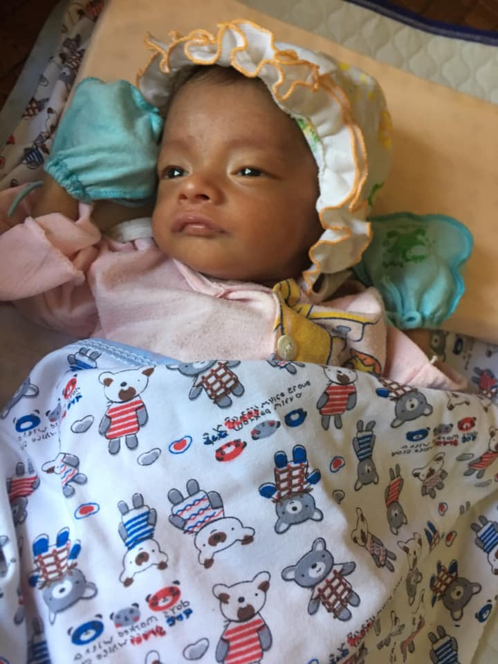 Thấy mắt em bé bị lệch, mẹ Hà Tĩnh chết đứng khi nghe bác sĩ kết luận ảnh 5 thay mat em be bi lech, me ha tinh chet dung khi nghe bac si ket luan: benh nang - 6