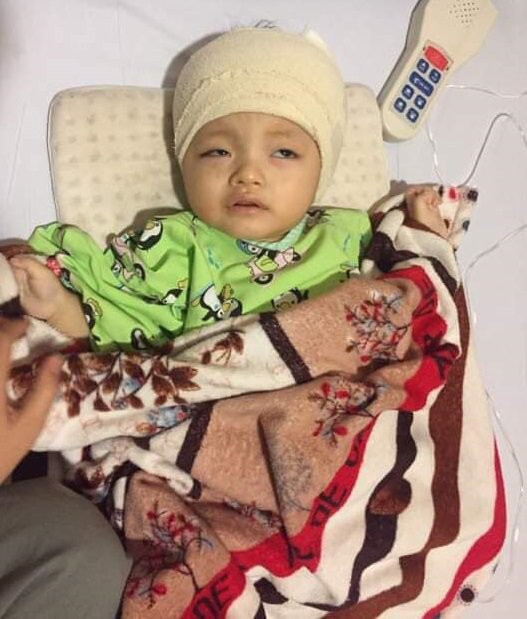 Thấy mắt em bé bị lệch, mẹ Hà Tĩnh chết đứng khi nghe bác sĩ kết luận ảnh 6 thay mat em be bi lech, me ha tinh chet dung khi nghe bac si ket luan: benh nang - 7