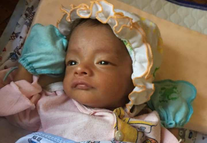Thấy mắt em bé bị lệch, mẹ Hà Tĩnh chết đứng khi nghe bác sĩ kết luận