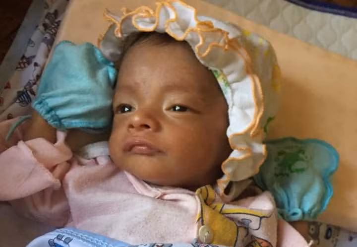 Thấy mắt em bé bị lệch, mẹ Hà Tĩnh chết đứng khi nghe bác sĩ kết luận