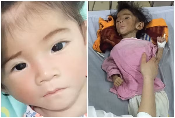 Cô nàng nhận nuôi bé Yến Nhi trong tình trạng suy dinh dưỡng nặng và mắc chứng bại não