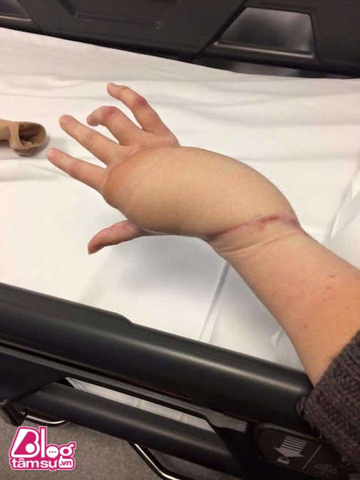 Những khoảnh khắc đáng sợ của các vận động viên thể thao ảnh 9 vdv-blogtamsuvn2