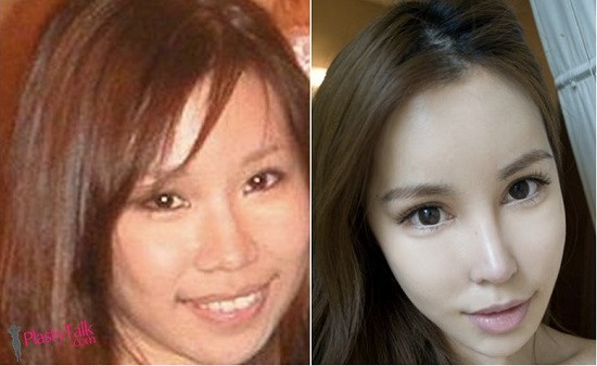 Hot girl số 1 của quốc đảo sư tử lộ ảnh trước khi phẫu thuật thẩm mỹ hình ảnh 3 hot girl so 1 cua quoc dao su tu lo anh truoc khi phau thuat tham my hinh anh 3