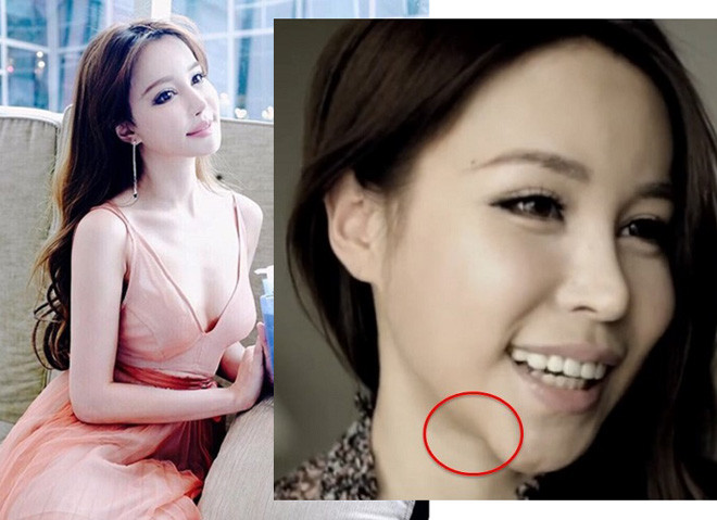 Hot girl số 1 của quốc đảo sư tử lộ ảnh trước khi phẫu thuật thẩm mỹ hình ảnh 5 hot girl so 1 cua quoc dao su tu lo anh truoc khi phau thuat tham my hinh anh 5