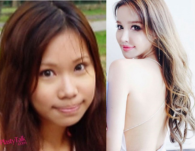 Hot girl số 1 của quốc đảo sư tử lộ ảnh trước khi phẫu thuật thẩm mỹ hình ảnh 2 hot girl so 1 cua quoc dao su tu lo anh truoc khi phau thuat tham my hinh anh 2