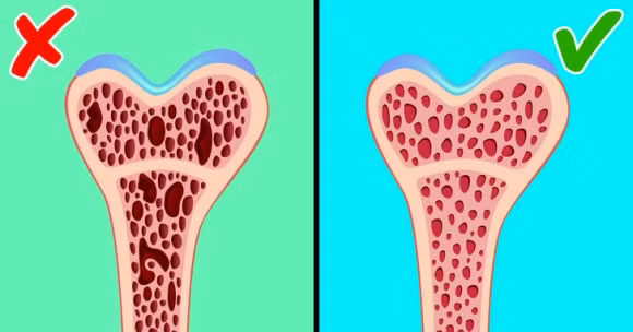 loãng xương, nguyên tắc bảo vệ xương, nguyên tắc bảo vệ xương khỏe mạnh