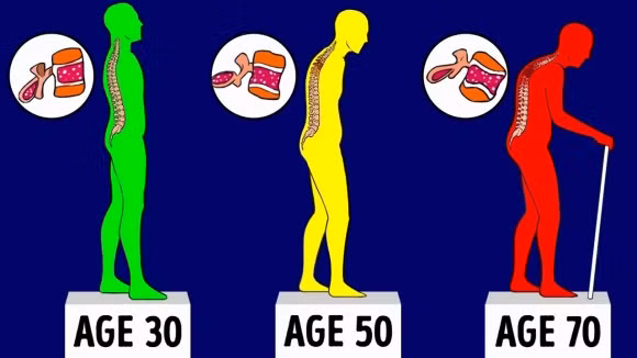 Để xương chắc khỏe khi ở độ tuổi 60 thì ngay độ tuổi 20, 30 bạn cần lưu ý những điều sau 