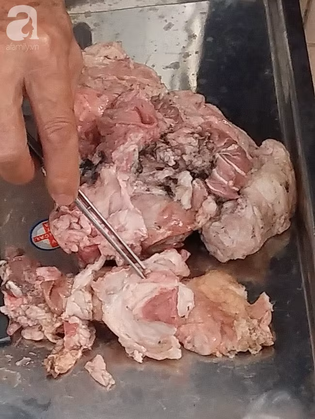 Phát hiện ổ sán dây lợn khiến ít nhất 108 người nhiễm bệnh: Nhiễm sán dây lợn nguy hiểm thế nào? - Ảnh 3.