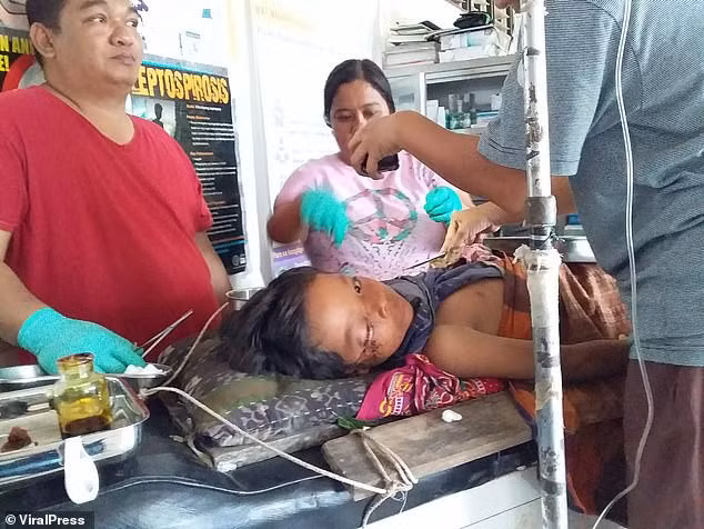 Con trai bị cá sấu cắn, cha mạo hiểm nhảy xuống nước làm 1 việc không phải ai cũng dám làm - Ảnh 1.