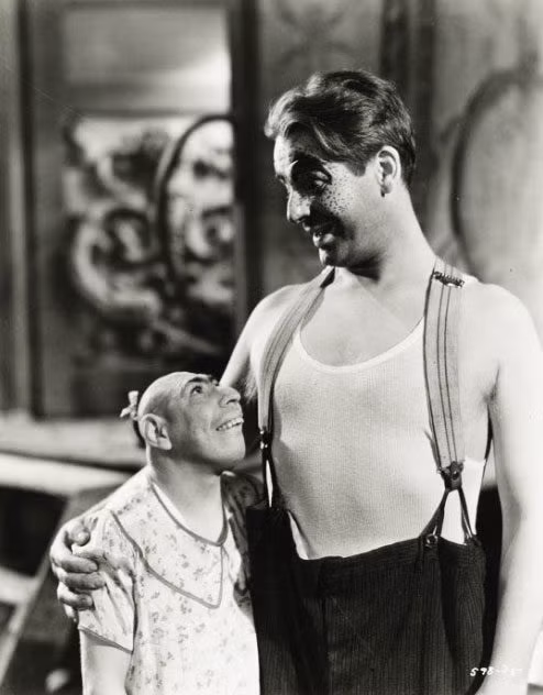 Schlitzie Simon Metz&nbsp;bị một dị tật từ nhỏ khiến cho não bộ của anh mãi mãi giữ kích thước lúc 3 tuổi, và kéo theo tâm lí và sự phát triển cũng dừng ở 3 tuổi. (Ảnh: Internet)