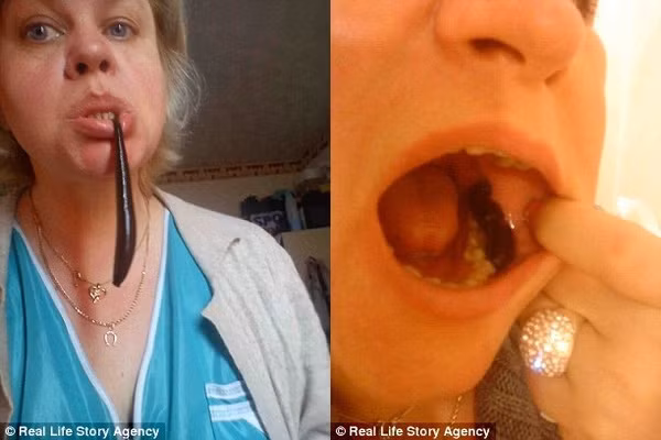 nguoi-phu-nu-giam-can-bang-dia