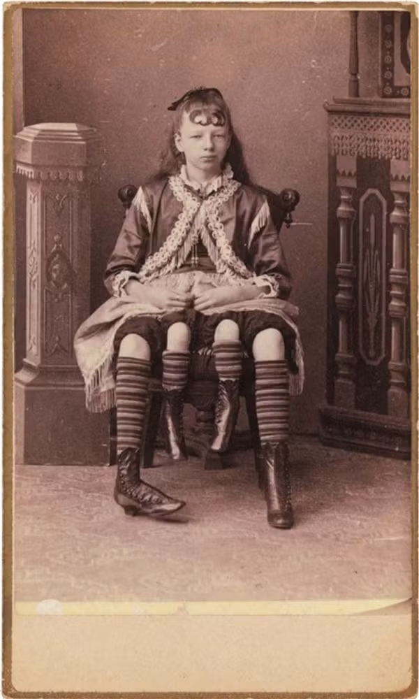 Cô gái có đến ... 4 chân. (Ảnh: Internet)