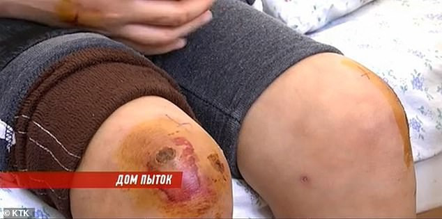 Mấy đời bánh đúc có xương: Dì ghẻ đánh đập con chồng như tra tấn thời trung cổ còn tự tay làm một việc khiến tội ác bị lộ tẩy - Ảnh 8. Mấy đời bánh đúc có xương: Dì ghẻ đánh đập con chồng như tra tấn thời trung cổ còn tự tay làm một việc khiến tội ác bị lộ tẩy - Ảnh 8.