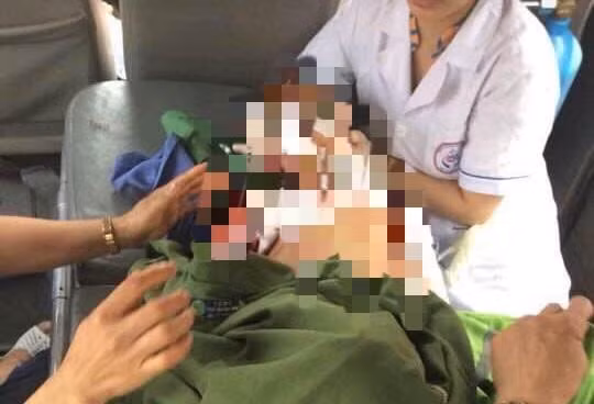 Bệnh nhi ở Thái Nguyên bị chó cắn đã không qua khỏi. Ảnh: BSCC.