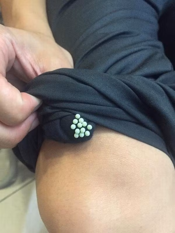 lon trai quan ao khi phoi, thoi quen sai lam giet chet ca nha vao mua he - 1