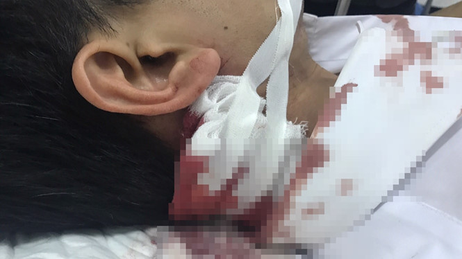 Thiếu tá Phạm Phú Hiệp bị thương ở cổ.