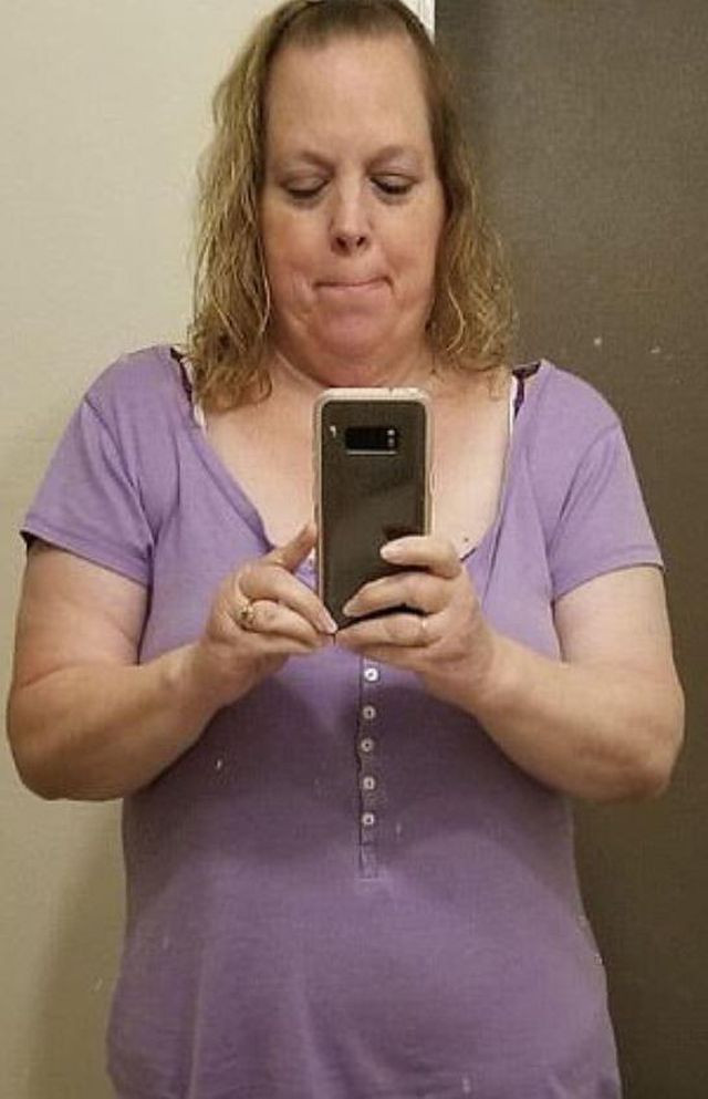 Choáng váng với khối u 22 kg lấy ra từ cơ thể bệnh nhân lạc nội mạc tử cung - 4