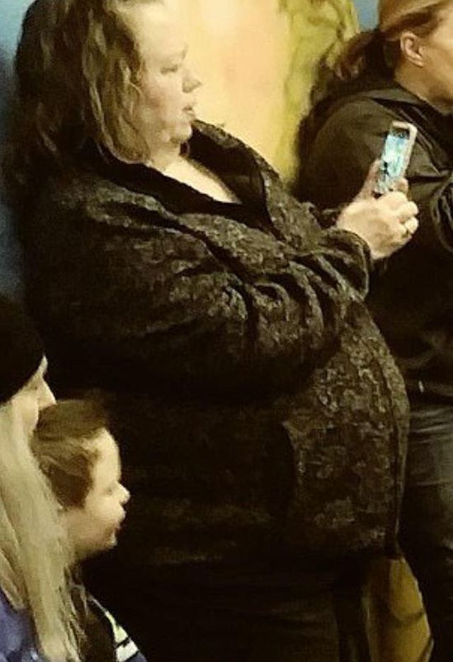 Choáng váng với khối u 22 kg lấy ra từ cơ thể bệnh nhân lạc nội mạc tử cung - 1