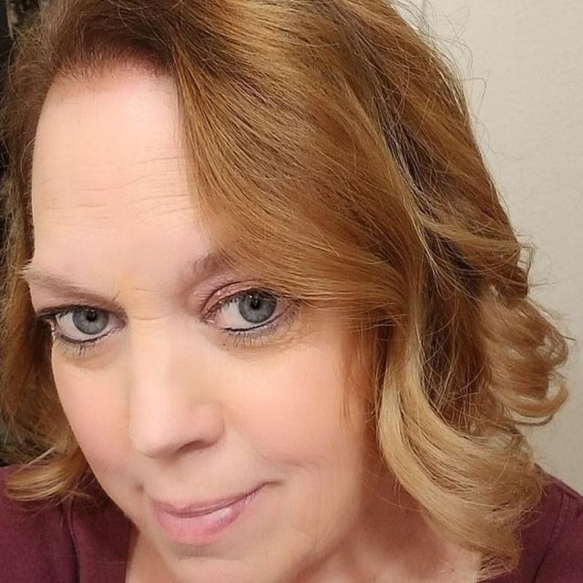 Choáng váng với khối u 22 kg lấy ra từ cơ thể bệnh nhân lạc nội mạc tử cung - 2