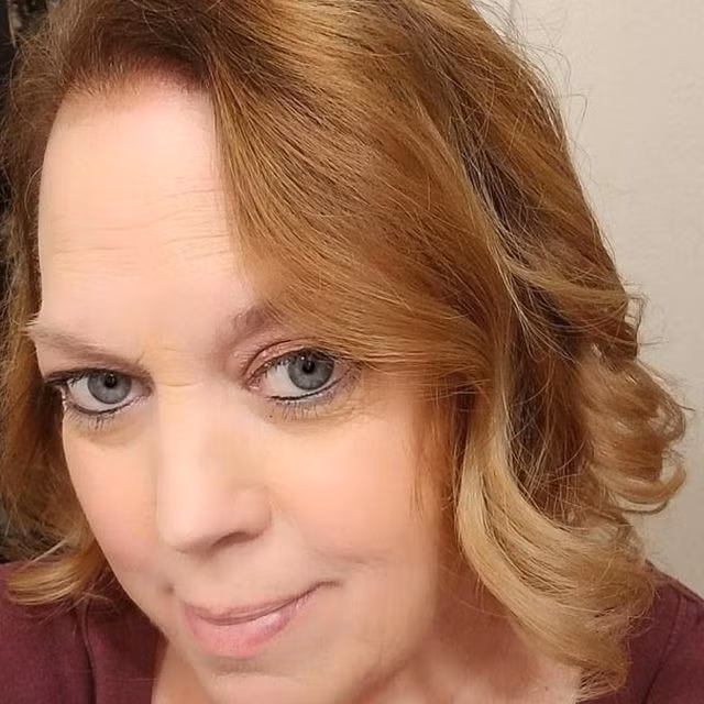 Choáng váng với khối u 22 kg lấy ra từ cơ thể bệnh nhân lạc nội mạc tử cung - 2