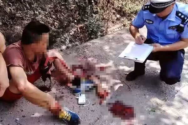 Bị xe cán đứt lìa tay vẫn bình tĩnh ngồi chờ người đến cứu