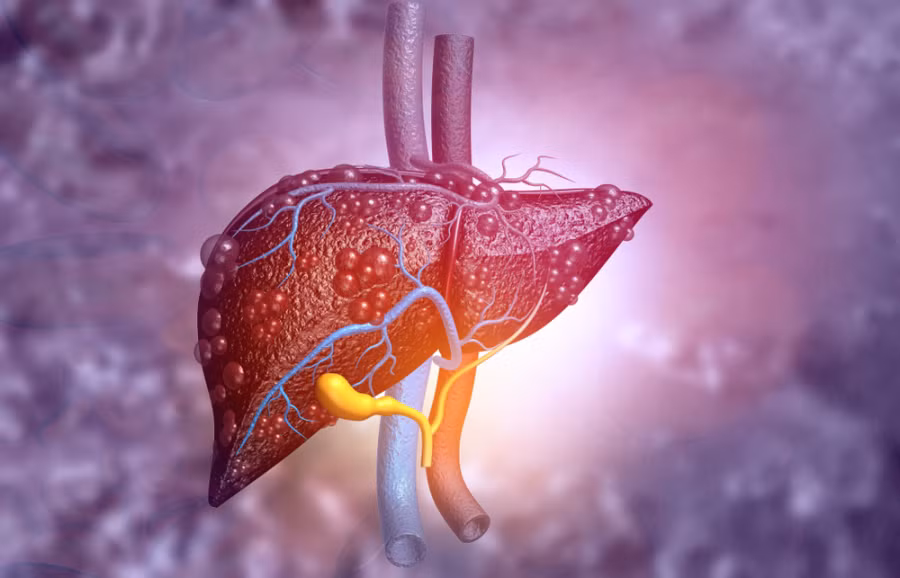 Ăn quá nhiều thịt đỏ dễ gây tích tụ carnitine gây xơ vữa động mạch và ảnh hưởng đến sức khỏe tim mạch.