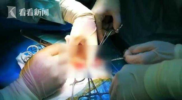 Bé trai 4 tuổi có bụng nhô cao như phụ nữ mang thai và nguyên nhân khiến mọi người giật mình - Ảnh 4. Bé trai 4 tuổi có bụng nhô cao như phụ nữ mang thai và nguyên nhân khiến mọi người giật mình - Ảnh 4.