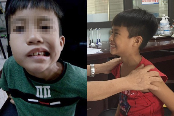 Nhiều trẻ méo miệng, liệt mặt do dùng điều hòa ngày nóng: Đây là cách sử dụng đúng nhất bố mẹ cần nhớ để bảo vệ con - Ảnh 1. Nhiều trẻ méo miệng, liệt mặt do dùng điều hòa ngày nóng: Đây là cách sử dụng đúng nhất bố mẹ cần nhớ để bảo vệ con - Ảnh 1.