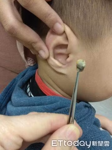 tuong con hu vi goi mai khong thua, di kham soc khi bac si loi thu nay tu tai con - 2