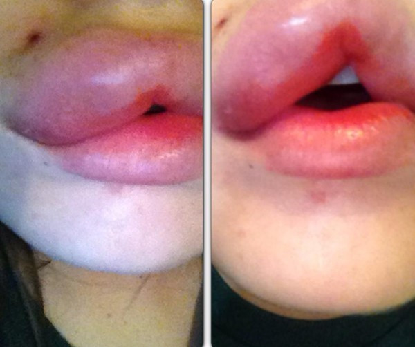 Những kiểu làm đẹp “tiền mất tật mang” thật đáng sợ.