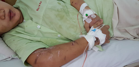 Lời kể rùng rợn của thai phụ bị giam cầm 20 ngày, bị đánh sẩy thai - ảnh 1