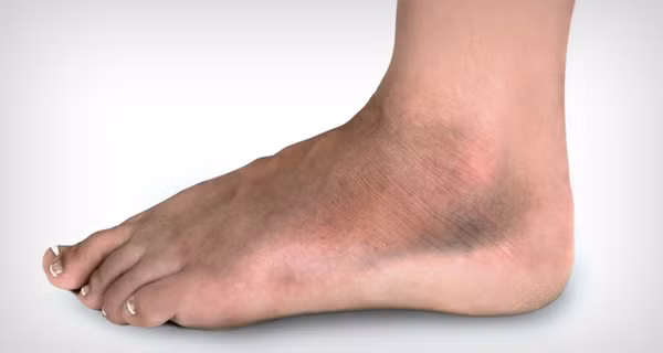 Nguy hiem cuc mau dong, 5 dau hieu khong the bo qua