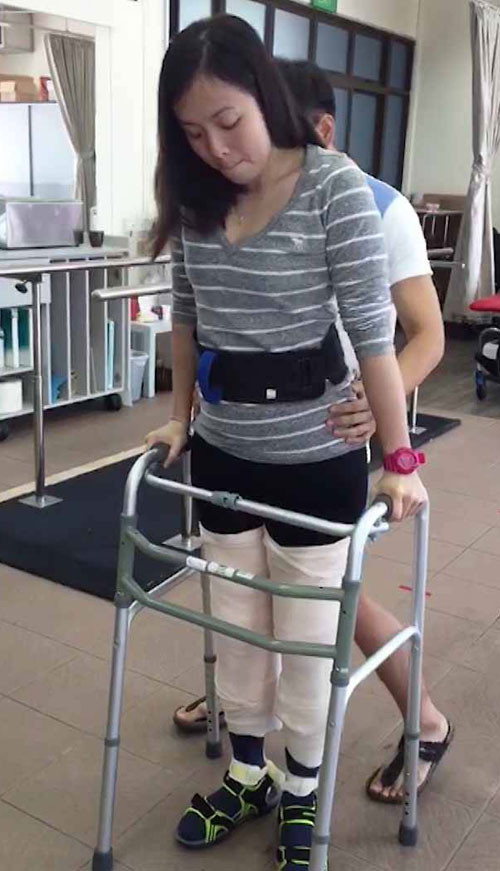 Ling bắt đầu tập luyện với khung tập đi cho đám cưới của mình. Ảnh: NVCC.