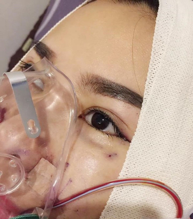 Hành trình “đại trùng tu” nhan sắc của Quế Vân: Thay 24 bộ răng, làm mũi 6 lần mong giống... Song Hye Kyo ảnh 2 Hành trình đại trùng tu tiền tỷ của Quế Vân: Thay 24 bộ răng vẫn chưa ưng, làm mũi 6 lần vì mong được như Song Hye Kyo-3