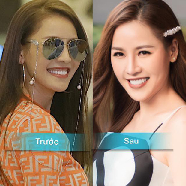 Hành trình “đại trùng tu” nhan sắc của Quế Vân: Thay 24 bộ răng, làm mũi 6 lần mong giống... Song Hye Kyo ảnh 7 Hành trình đại trùng tu tiền tỷ của Quế Vân: Thay 24 bộ răng vẫn chưa ưng, làm mũi 6 lần vì mong được như Song Hye Kyo-8