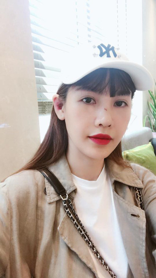 Hành trình “đại trùng tu” nhan sắc của Quế Vân: Thay 24 bộ răng, làm mũi 6 lần mong giống... Song Hye Kyo ảnh 5 Hành trình đại trùng tu tiền tỷ của Quế Vân: Thay 24 bộ răng vẫn chưa ưng, làm mũi 6 lần vì mong được như Song Hye Kyo-6