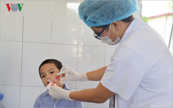 chó nhà cắn rách mặt một cháu bé 5 tuổi ở sơn la hình 1 cho nha can rach mat mot chau be 5 tuoi o son la hinh 1