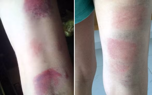 Tam dinh chi co giao bi to danh bam tim chan 22 hoc sinh o Ba Ria – Vung Tau hinh anh 2