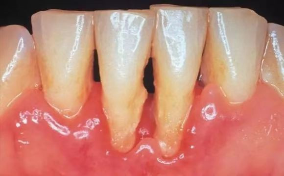 Người phụ nữ sảy thai 4 lần trong 3 năm vì căn bệnh ai cũng biết nhưng không phòng tránh - Ảnh 5. Người phụ nữ sảy thai 4 lần trong 3 năm vì căn bệnh ai cũng biết nhưng không phòng tránh - Ảnh 5.