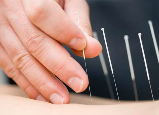 Châm cứu là một trong những niềm tự hào của y học cổ truyền Trung Hoa, nhưng vấp phải nhiều sự hoài nghi của khoa học phương Tây.