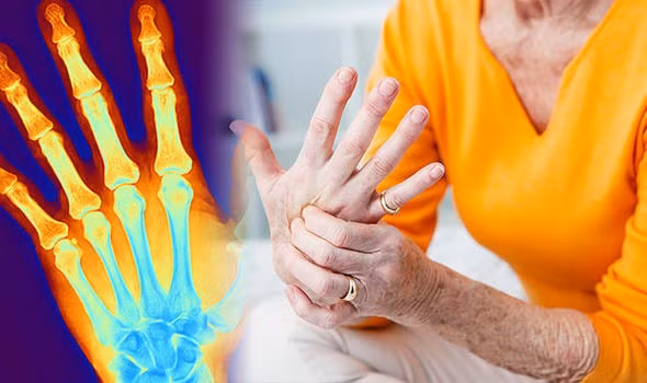 Hãy tạo cho mình những thói quen này hàng ngày để ngăn ngừa các triệu chứng đau khớp ở đầu gối, hông và bàn tay - Ảnh 1.