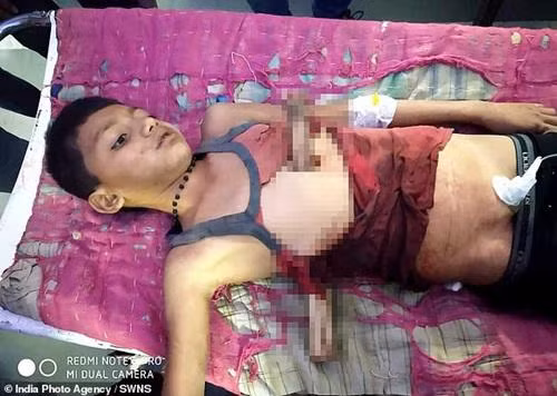 cau be song sot ky dieu sau khi bi canh cay dam xuyen nguoi van co dat em ve nha - 1