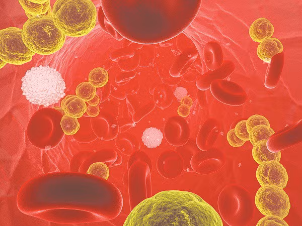 Bé 6 tuổi suýt mất mạng vì vết thương nhỏ: Nguyên nhân có thể khiến bố mẹ giật mình-1