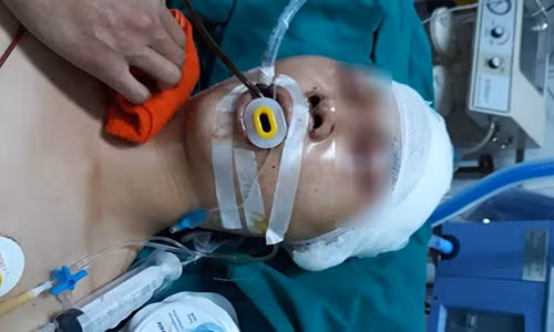 Hà Nội: Nửa đêm, nam sinh 17 tuổi bị đánh chấn thương sọ não