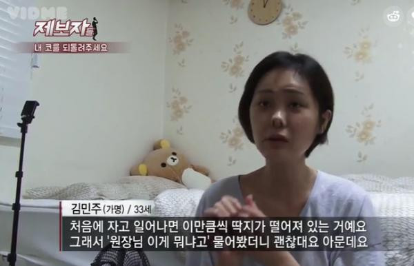 Phẫu thuật thẩm mỹ hỏng, cô gái Hàn Quốc nhận hậu quả đáng sợ - Ảnh 3. Cô gái sở hữu chiếc mũi kinh dị ảnh 2