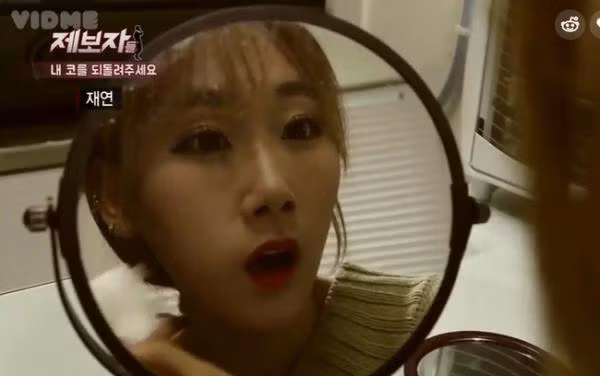 Cô gái sở hữu chiếc mũi kinh dị ảnh 1