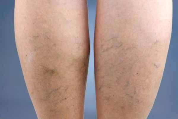 neu co 4 dau hieu nay o chan, di kham ngay vi can benh gay chet nhanh hon ung thu - 4